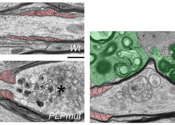 Effective removal of abnormal myelin allows survival of nerve fibers targeted by adaptive immune cells