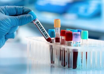 Genetic test could identify the most effective antidepressant for each patient