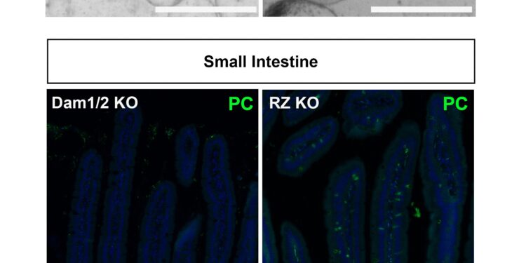 Key mechanism in stem cell change identified