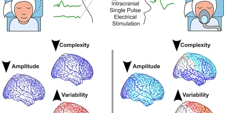 Study reveals engagement of different cortical networks while humans are unconscious