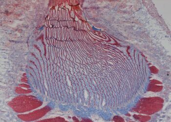 The dynamic bio-interface between mussel tissue and byssus plays an important role in rapid release
