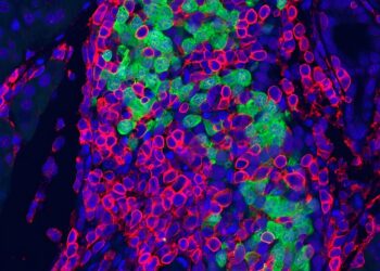 Disruption of RNA editing mimics early-stage disease without virus involvement
