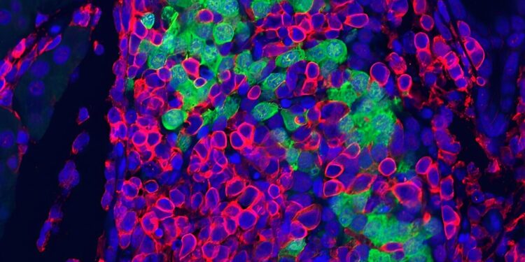 Disruption of RNA editing mimics early-stage disease without virus involvement