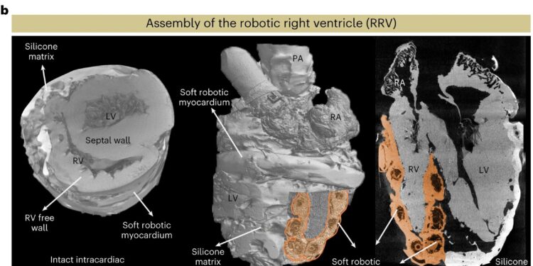 Engineers design robotic replica of right chamber of heart