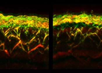 Examine Diabetes with Skin Scanner and AI