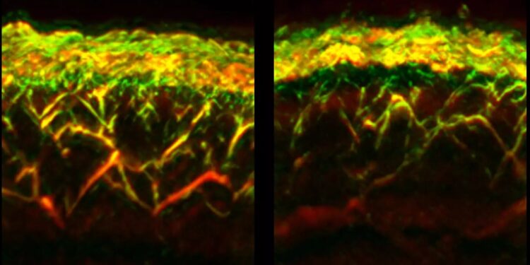 Examine Diabetes with Skin Scanner and AI