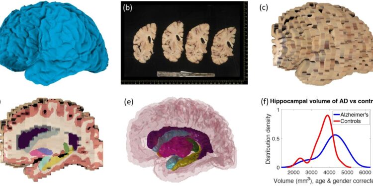 New computer tools can reconstruct the brain in 3D from biobank photos