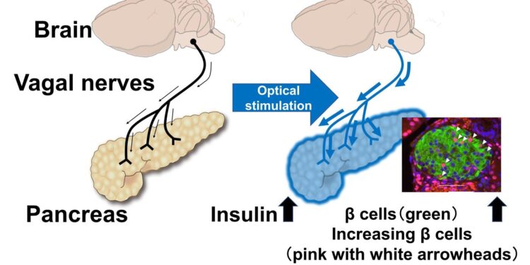 Research finds that stimulating nerves connected to the pancreas can regenerate insulin-producing cells