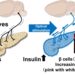 Research finds that stimulating nerves connected to the pancreas can regenerate insulin-producing cells