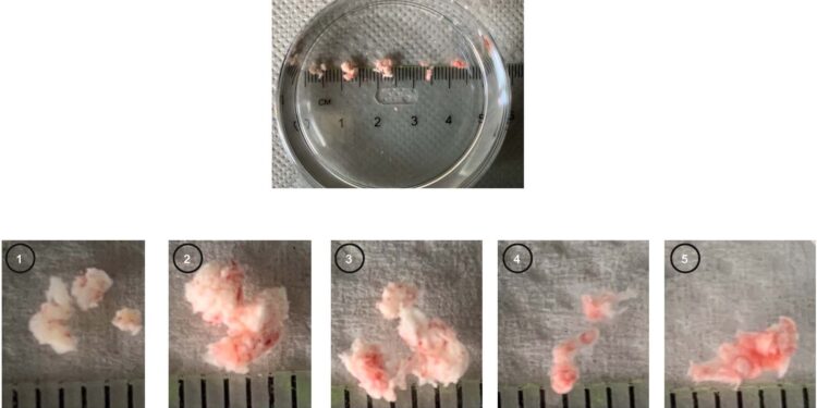 Researchers discover potential source of stem cells in injured patients’ brains