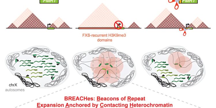Researchers discover unexpected molecular pattern in fragile X syndrome
