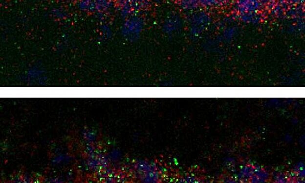 Researchers identify traces of trauma in the young brain and suggest how to erase them