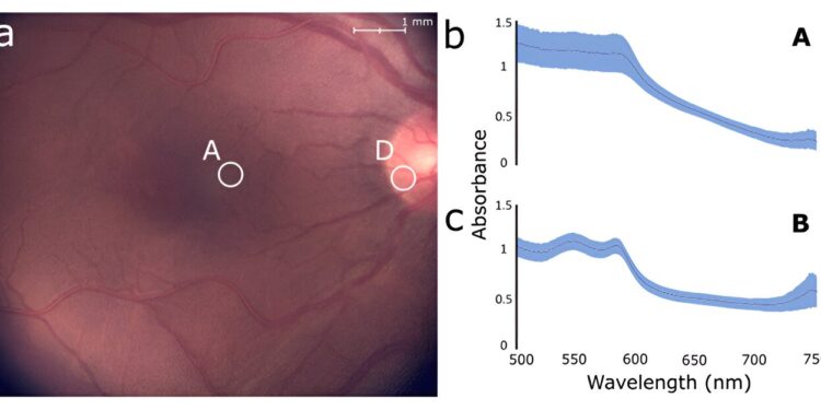 Scientists develop versatile imaging system that will help diagnose back-of-the-eye pathologies