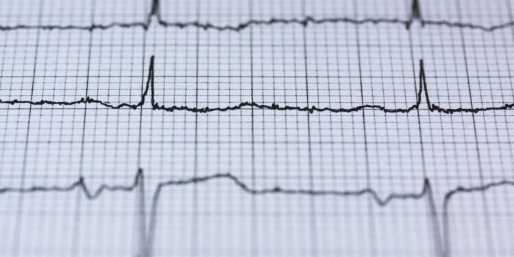 Smartwatches can detect abnormal heart rhythms in children, study finds