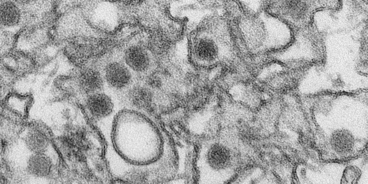 Study reveals Zika transformation machinery and possible vulnerability