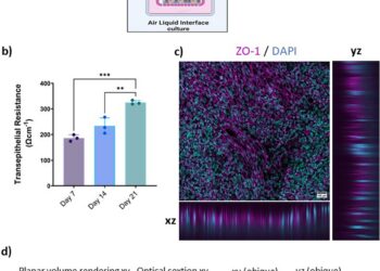 Study shows COVID-19 infection alters gene transcription of olfactory mucosa cells in Alzheimer’s disease