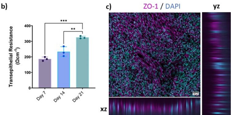Study shows COVID-19 infection alters gene transcription of olfactory mucosa cells in Alzheimer’s disease