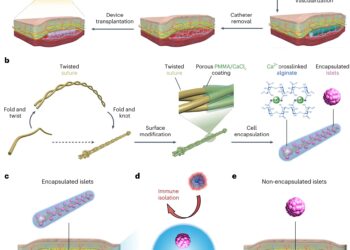 Subcutaneous implant could treat type I diabetes