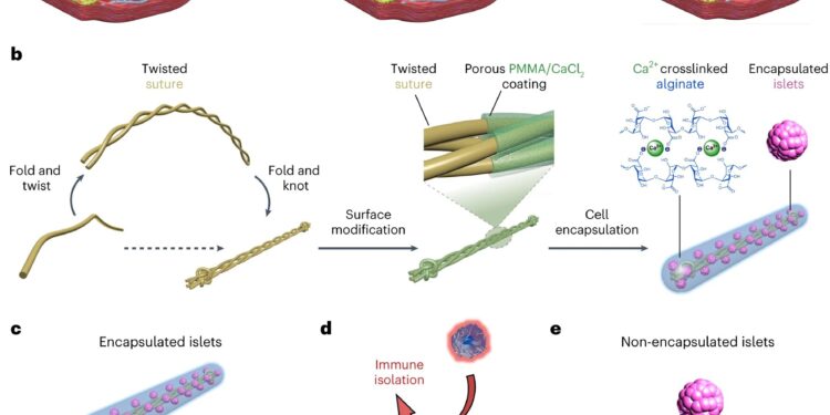 Subcutaneous implant could treat type I diabetes