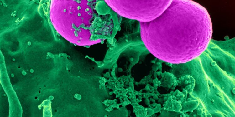 Suppressing part of the innate immune system to improve cancer treatment