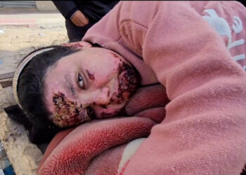 World Health: The destruction of Kamal Adwan Hospital in Gaza is shocking