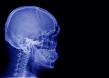 he survives a huge stake driven through his skull