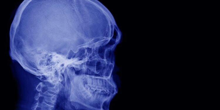 he survives a huge stake driven through his skull