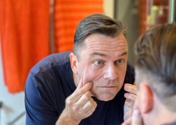 this rare disease makes the skin elastic