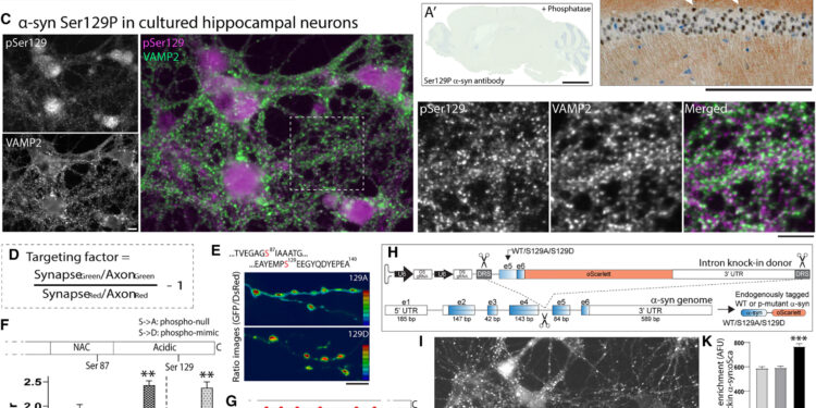 A common marker of neurological diseases may play a role in brain health