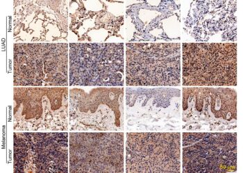 A new regulator of immune evasion in cancer identified