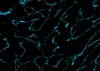 A new way to visualize brain cancer at the nanoscale