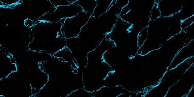 A new way to visualize brain cancer at the nanoscale