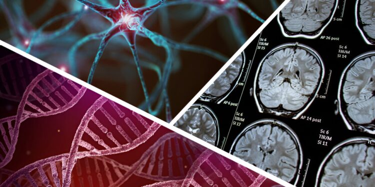 A ‘radically different’ way of looking at Parkinson’s disease