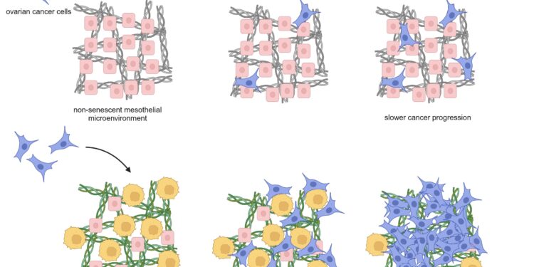Aging cells could promote the spread of ovarian cancer, scientists say