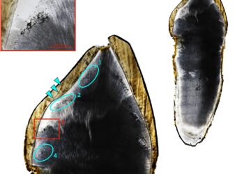 Archaeological evidence of seasonal vitamin D deficiency discovered in England