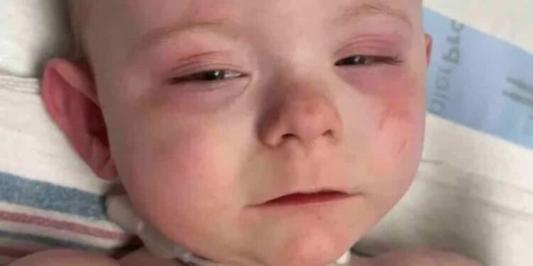“Bad house”: a baby injured during a police intervention, denounces his mother