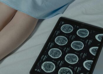 Cognitive behavioral therapy changes brain activity in anxious children, study finds