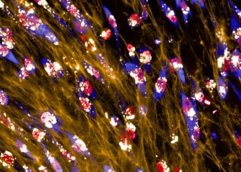 Energy-starved breast cancer cells consume their environment for fuel, study finds
