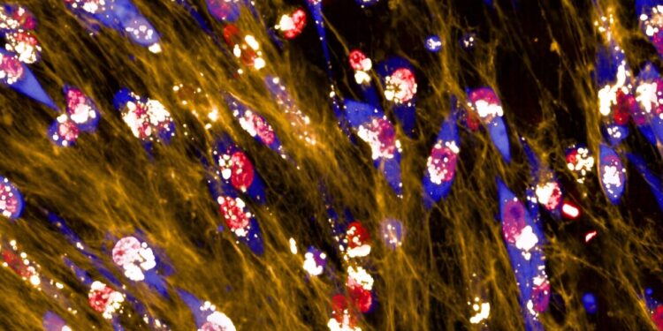 Energy-starved breast cancer cells consume their environment for fuel, study finds