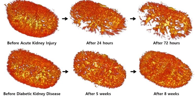 First successful imaging without contrast agent of the complex structure of the kidneys