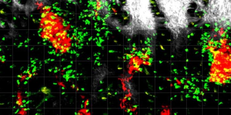 From helpers to melanoma fighters