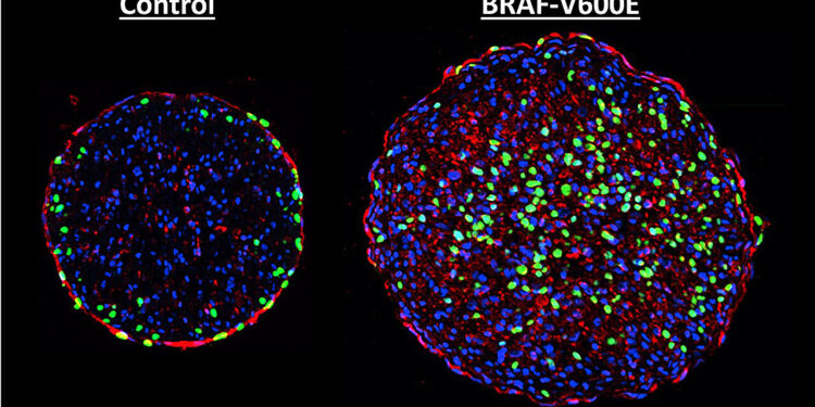Harnessing skin cancer genes to heal hearts
