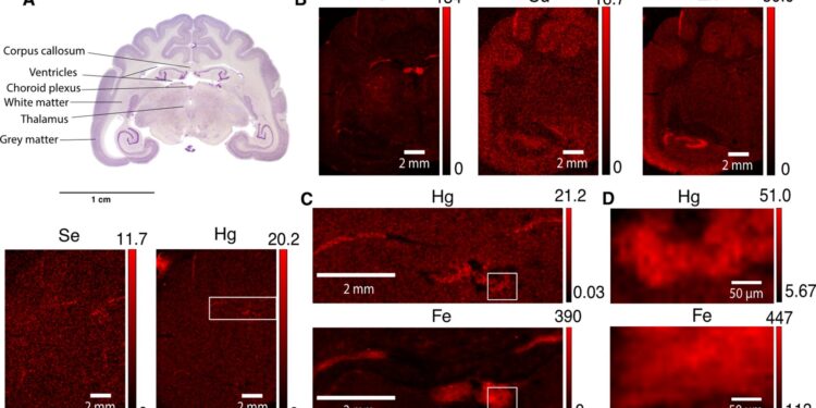 High mercury levels attributed to particular cell types in mammalian brains