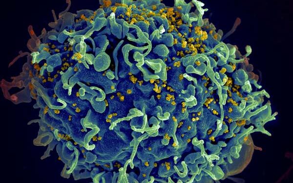 Higher viral load during HIV infection may shape viral evolution