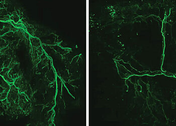 Lifespan increases in mice when specific brain cells are activated, study finds