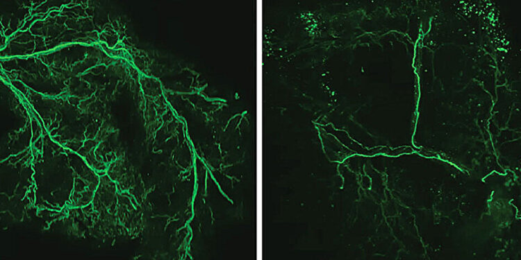 Lifespan increases in mice when specific brain cells are activated, study finds