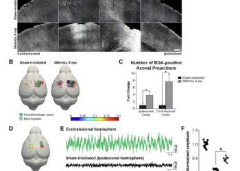 Neuroscientists discover therapeutic potential of low-dose ionizing radiation for head injuries and ischemic strokes
