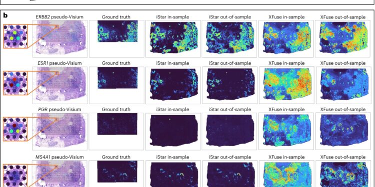 New AI tool helps focus faster and more precisely on precision cancer pathology and beyond