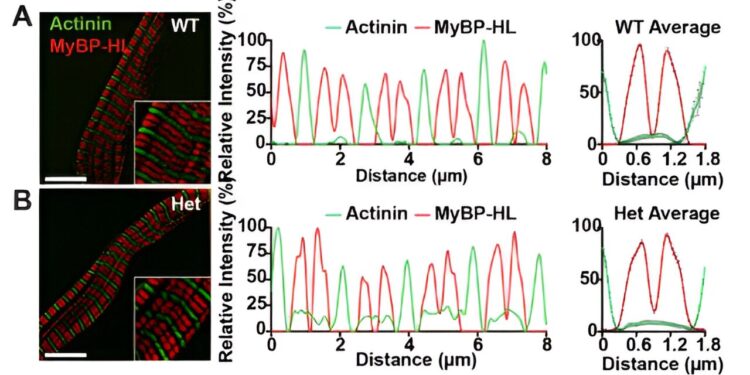 New protein interactions could serve as a biomarker for heart disease