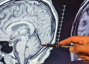 New study finds traumatic stress associated with smaller cerebellum